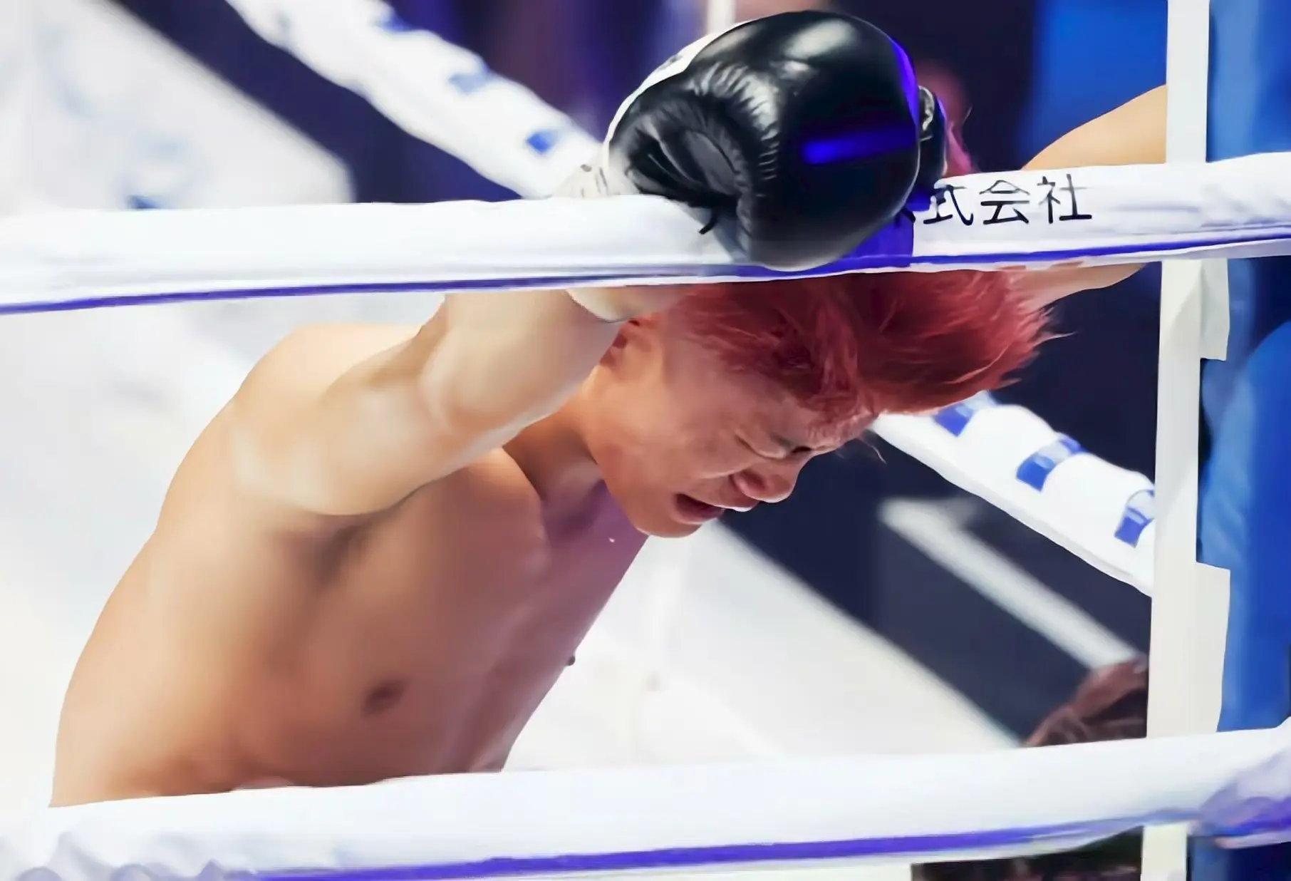 岁前拳王伤 岁前拳王伤